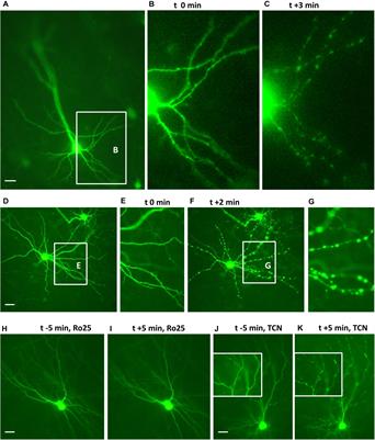 GluN2B but Not GluN2A for Basal Dendritic Growth of Cortical Pyramidal Neurons